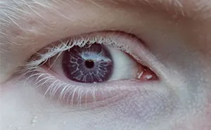 39 People Whose Genetics Made Them Unique