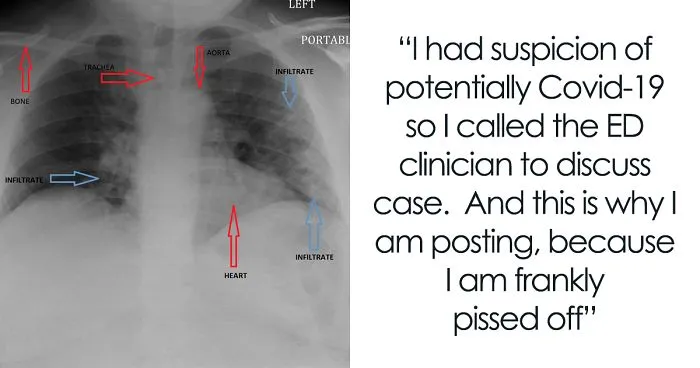 Angry Radiologist Asks To Share His Message After A Potential Coronavirus Carrier Takes A Plane Full Of People