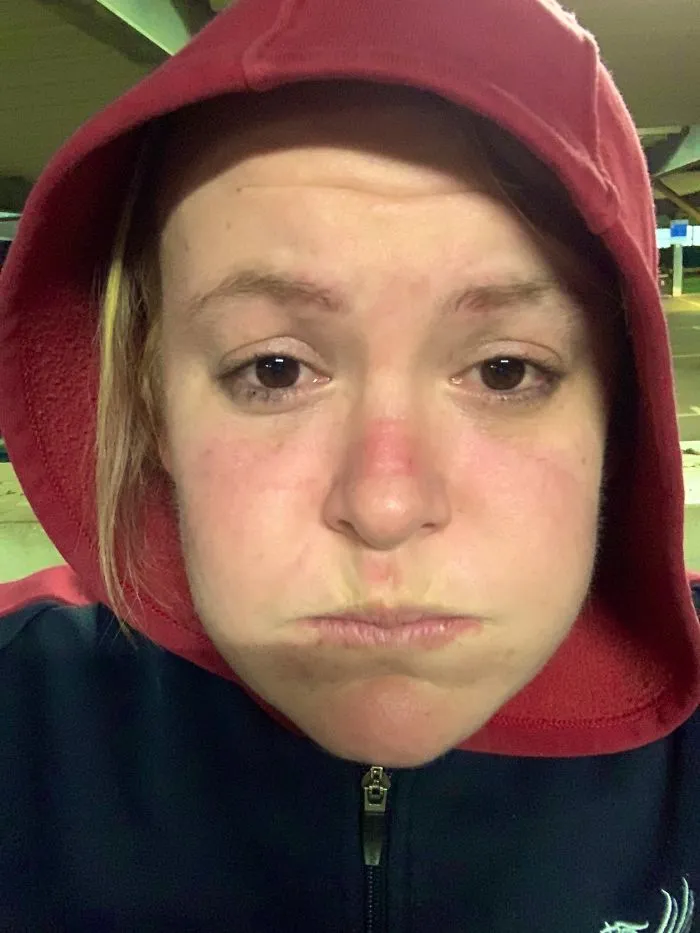 This Was Me Last Night On Shift As A Critical Nurse When I Went On My Lunch Hour After Wearing A Mask And All The Gear And Do You Know What I Wouldn’t Be Doing Anything Else!