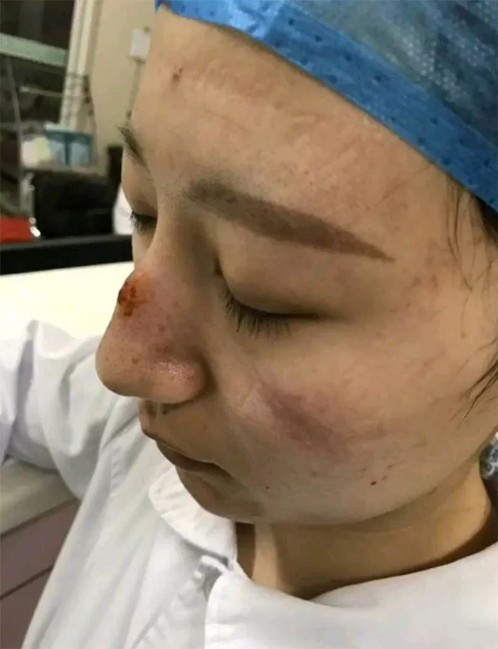 Marcas en la cara
