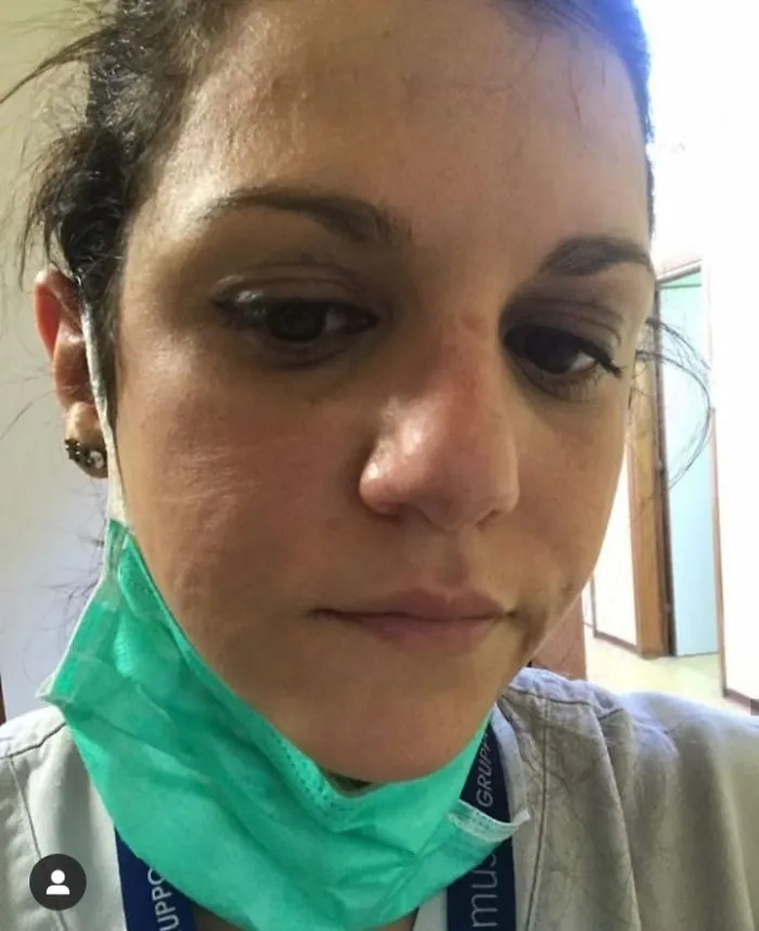 Nurse After Hours Of Work In Intensive Care