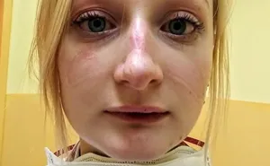 34 Heartbreaking Pics Of Overworked Doctors Are Going Viral, Proving That They Too Have Human Limits