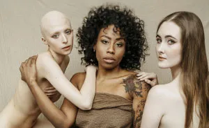 For This International Women‘s Day We Did A Special Photoshoot With Women That Represent People With Disabilities And Visible Differences