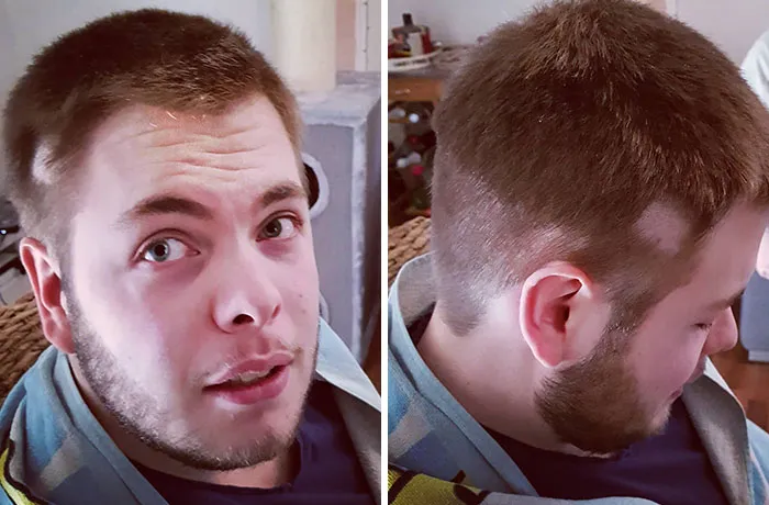 Aw Snap, We Have To Go Bald