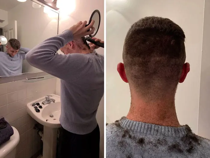 I Need To Tweet This So I Can Put It In My Blog So Here Is What Happened When I Cut My Ear