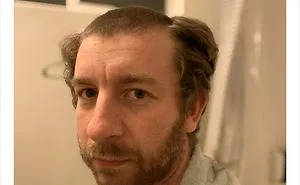 Unfortunate Quarantine Haircuts (30 New Pics)