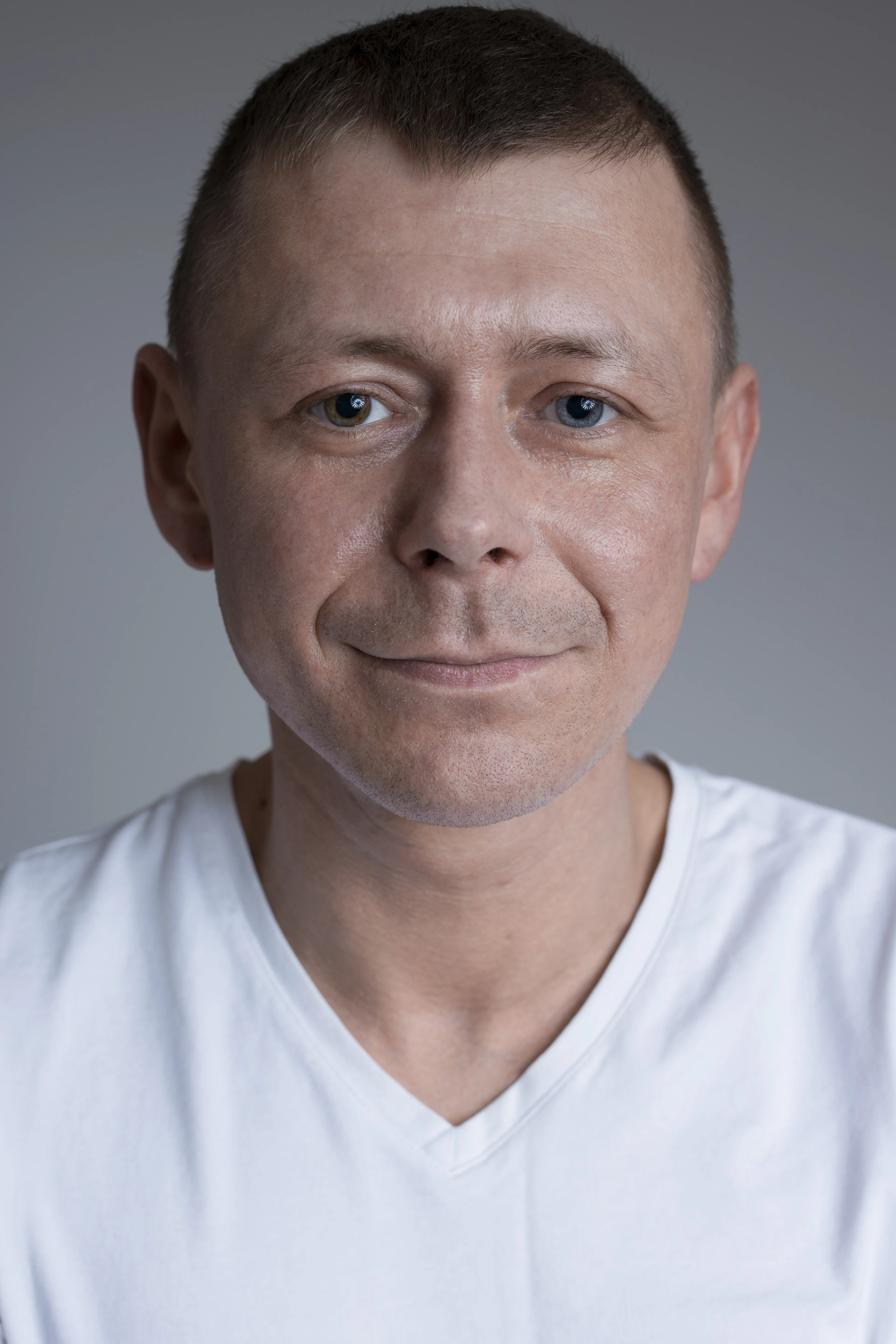 #varicoloreds Is A Series Of Portraits Of Colorful People With Heterochromia