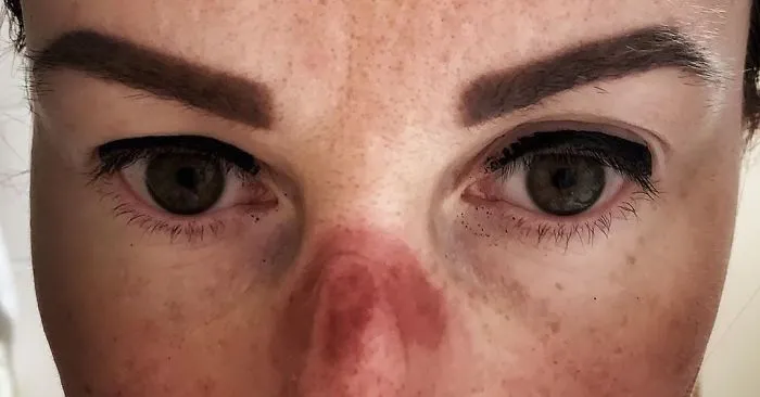 A Czech Nurse Shares What Her Face Looks Like After Working At A Hospital