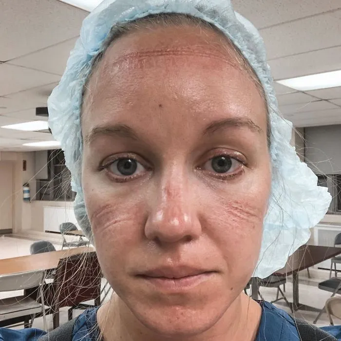 "Beauty Marks"