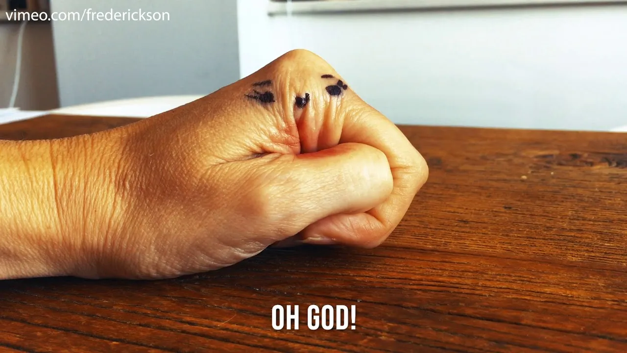 In These Days Of Obsessive Hand-Washing, Our Hands Are Doing It Tough!