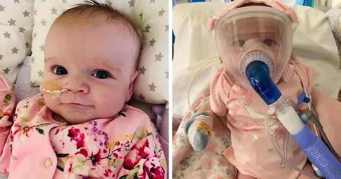 6-Month-Old Baby Survives Coronavirus After Fighting Heart Conditions And Lung Problems