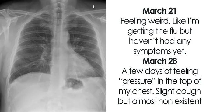 Man Details What It Really Feels Like To Have A 'Mild' Case Of Covid-19