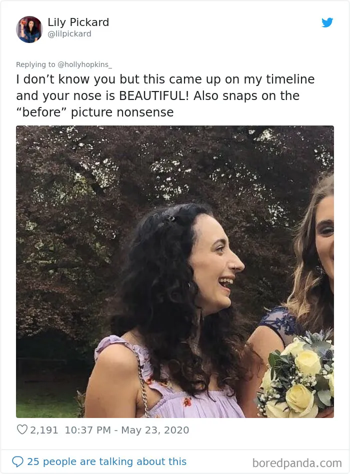 Women Are Posting Their Noses That Look Like “Before” Photos