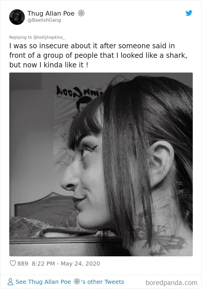 Women Are Posting Their Noses That Look Like “Before” Photos