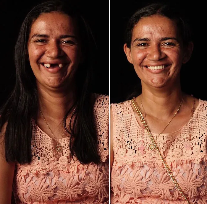 Brazilian Dentist Travels To Fix The Teeth Of Less-Fortunate People For Free And Here Are 30 New Transformations