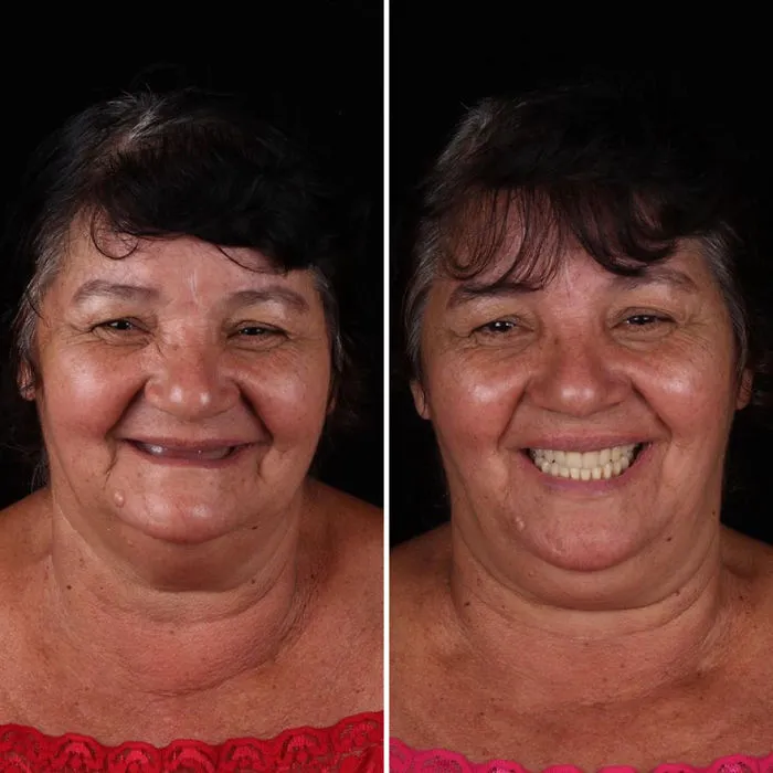 Brazilian Dentist Travels To Fix The Teeth Of Less-Fortunate People For Free And Here Are 30 New Transformations