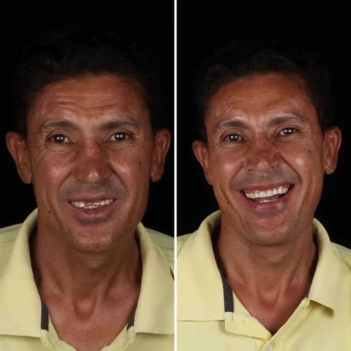 Brazilian Dentist Travels To Fix The Teeth Of Less-Fortunate People For Free And Here Are 30 New Transformations