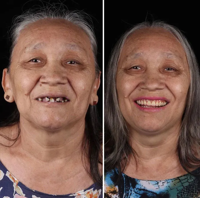 Brazilian Dentist Travels To Fix The Teeth Of Less-Fortunate People For Free And Here Are 30 New Transformations