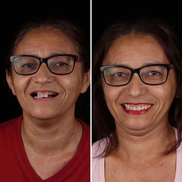 Brazilian Dentist Travels To Fix The Teeth Of Less-Fortunate People For Free And Here Are 30 New Transformations