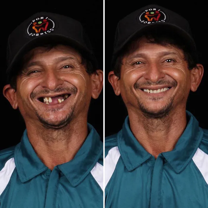 Brazilian Dentist Travels To Fix The Teeth Of Less-Fortunate People For Free And Here Are 30 New Transformations