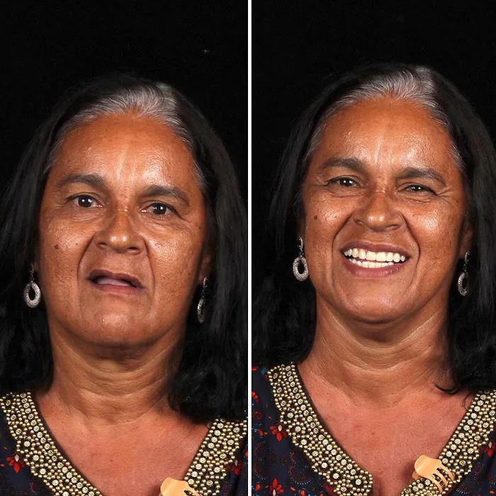 Brazilian Dentist Travels To Fix The Teeth Of Less-Fortunate People For Free And Here Are 30 New Transformations