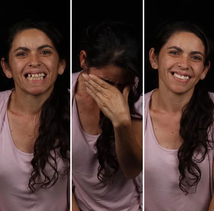 Brazilian Dentist Travels To Fix The Teeth Of Less-Fortunate People For Free And Here Are 30 New Transformations