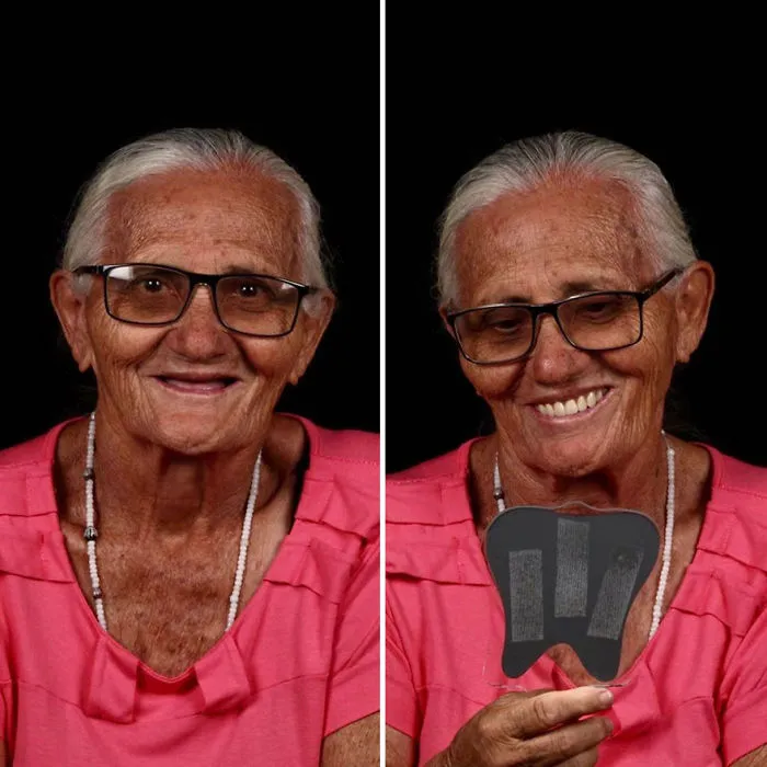 Brazilian Dentist Travels To Fix The Teeth Of Less-Fortunate People For Free And Here Are 30 New Transformations