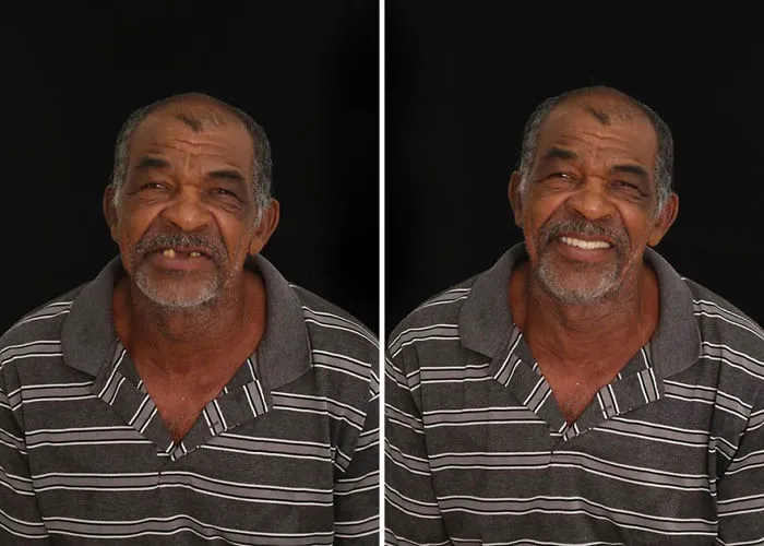Brazilian Dentist Travels To Fix The Teeth Of Less-Fortunate People For Free And Here Are 30 New Transformations