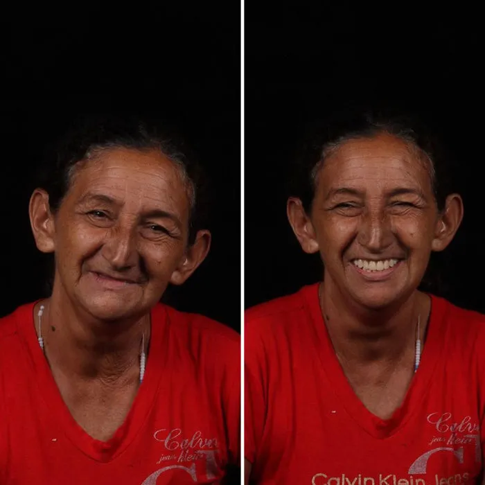 Brazilian Dentist Travels To Fix The Teeth Of Less-Fortunate People For Free And Here Are 30 New Transformations