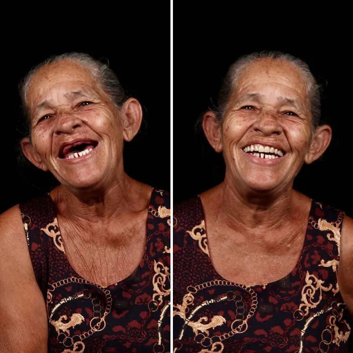 Brazilian Dentist Travels To Fix The Teeth Of Less-Fortunate People For Free And Here Are 30 New Transformations
