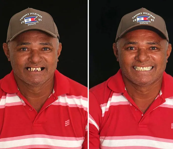 Brazilian Dentist Travels To Fix The Teeth Of Less-Fortunate People For Free And Here Are 30 New Transformations