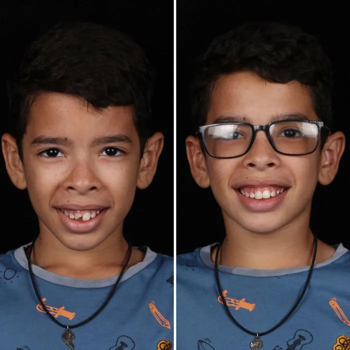 Brazilian Dentist Travels To Fix The Teeth Of Less-Fortunate People For Free And Here Are 30 New Transformations