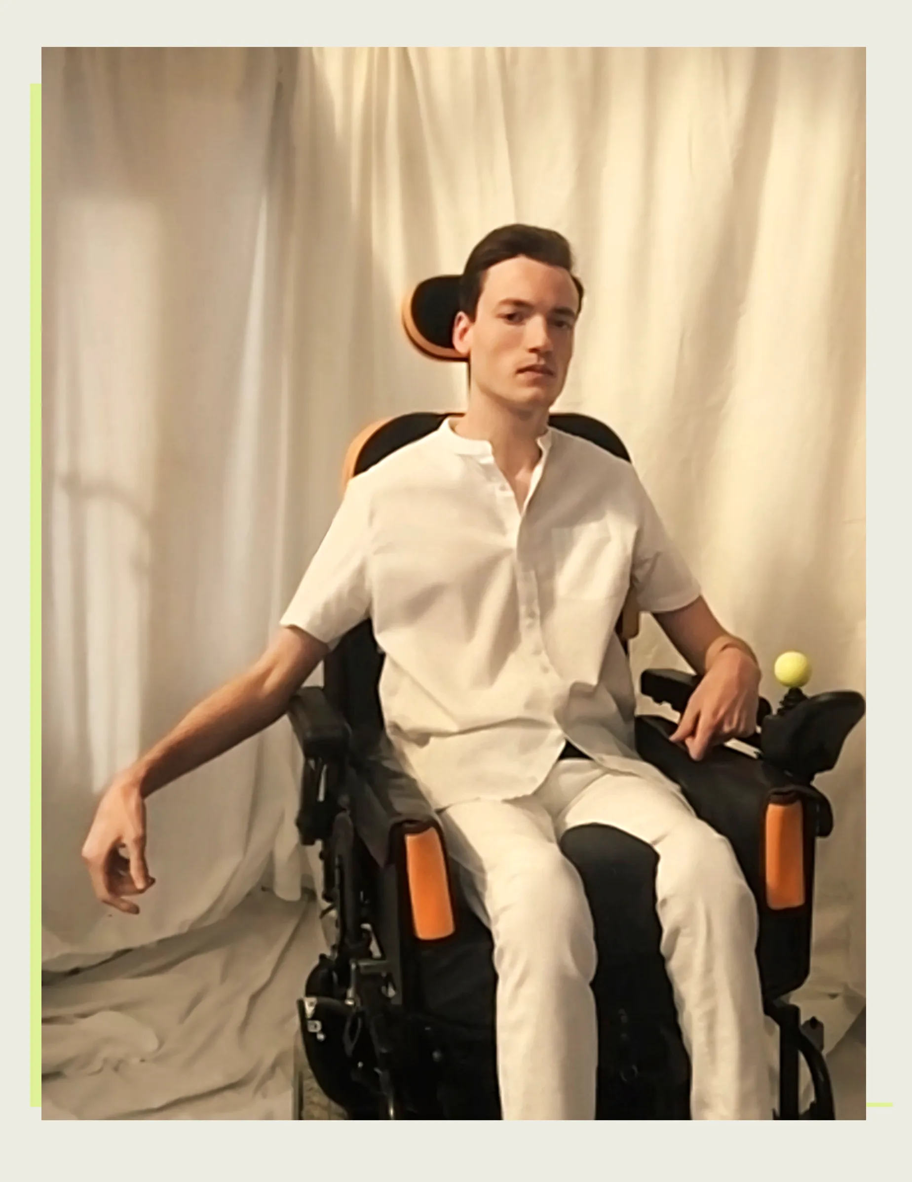 Models With Disabilities And Visbible Differences Take Part In Unique Photoshoots At Home. Project Isolation.