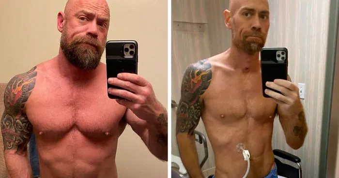 Man Shares An Eye-Opening Pic Showing What Covid-19 Did To Him After 6 Weeks In A Hospital