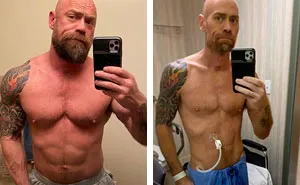 Man Shares An Eye-Opening Pic Showing What Covid-19 Did To Him After 6 Weeks In A Hospital