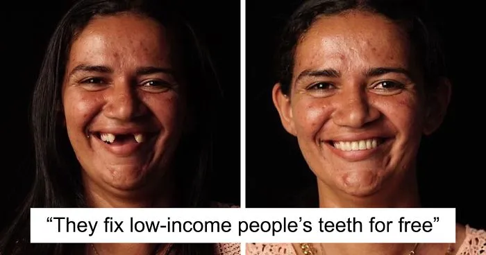 Brazilian Dentist Travels To Fix The Teeth Of Less-Fortunate People For Free And Here Are 30 New Transformations