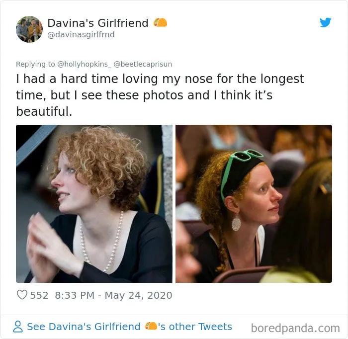 Women Are Posting Their Noses That Look Like “Before” Photos