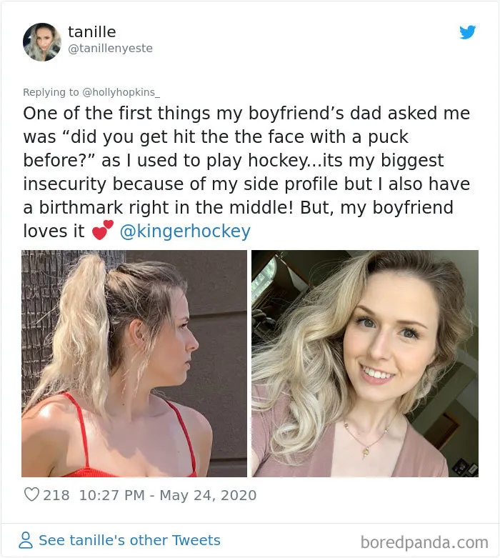 Women Are Posting Their Noses That Look Like “Before” Photos