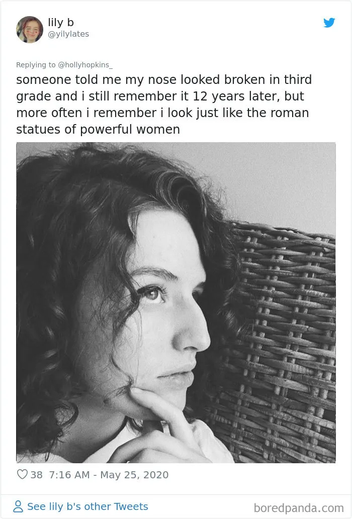 Women Are Posting Their Noses That Look Like “Before” Photos