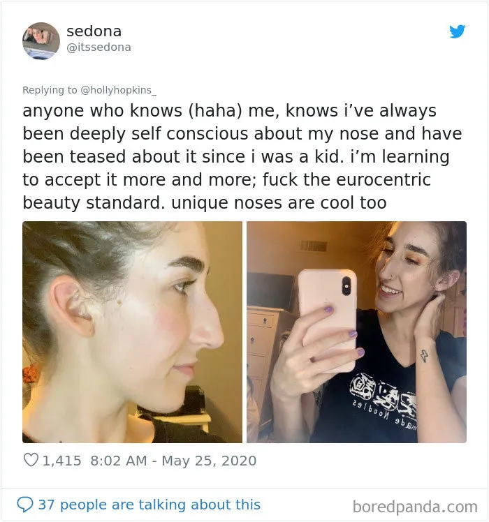 Women Are Posting Their Noses That Look Like “Before” Photos