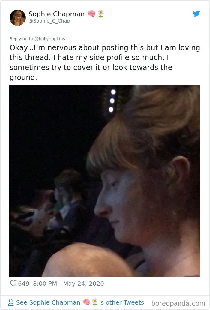 Women Are Posting Their Noses That Look Like “Before” Photos