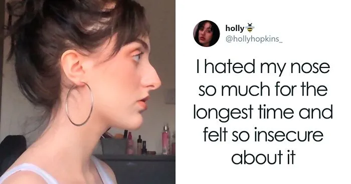 Women Are Posting Their Noses That Look Like “Before” Photos