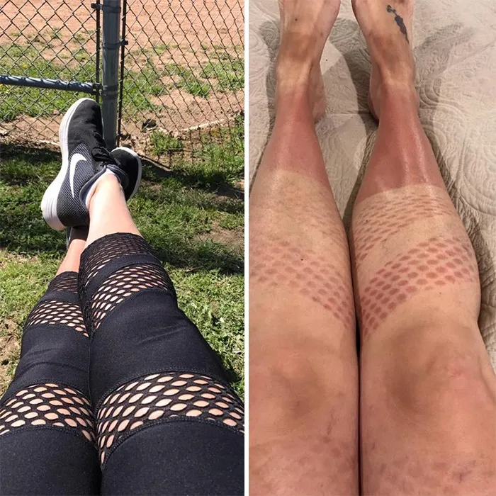 When The Sun's Out And You Don't Think It Through