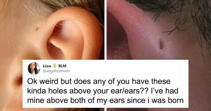People Are Realizing That Those Tiny Holes Above Their Ears May Have An Evolutionary Explanation