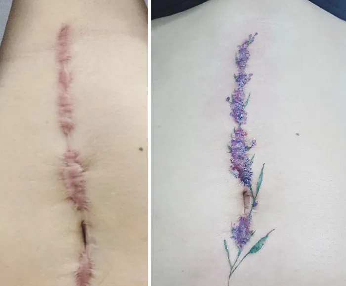 30 Times People Asked To Cover Up Their Scars, And This Tattoo Artist Nailed It