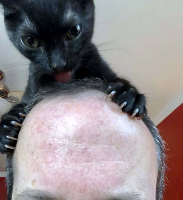 Scalp Massage