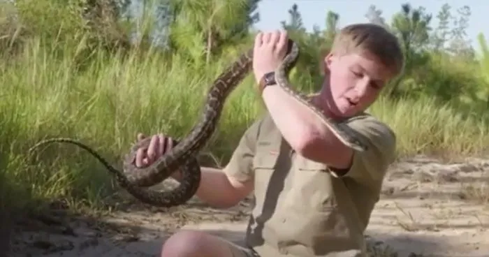Robert Irwin Gets Bitten In The Face By A Snake, Happily Poses For A Photo Afterwards