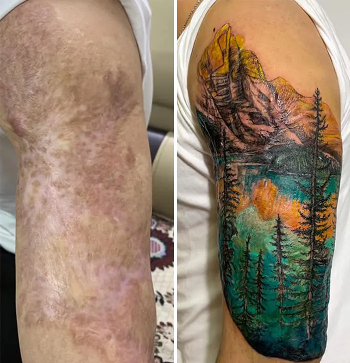 30 Times People Asked To Cover Up Their Scars, And This Tattoo Artist Nailed It