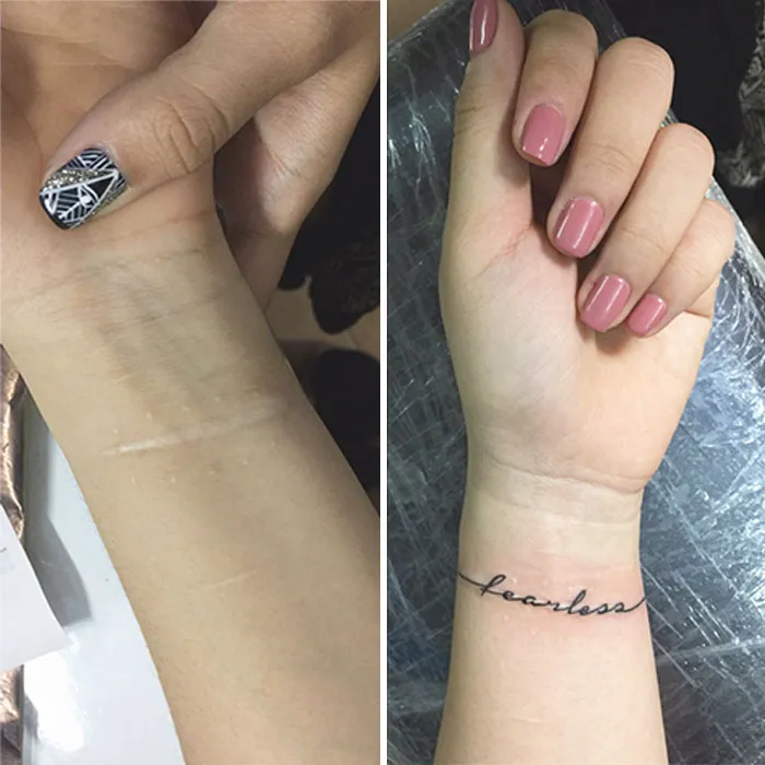30 Times People Asked To Cover Up Their Scars, And This Tattoo Artist Nailed It