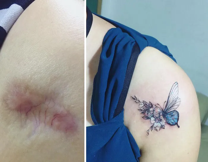 30 Times People Asked To Cover Up Their Scars, And This Tattoo Artist Nailed It